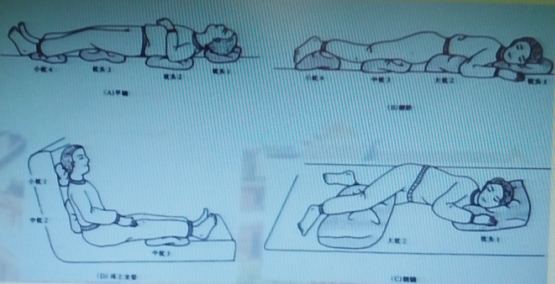 除非病情需要,应避免长时间摇高床头超过30度体位,半坐卧位和90度侧卧